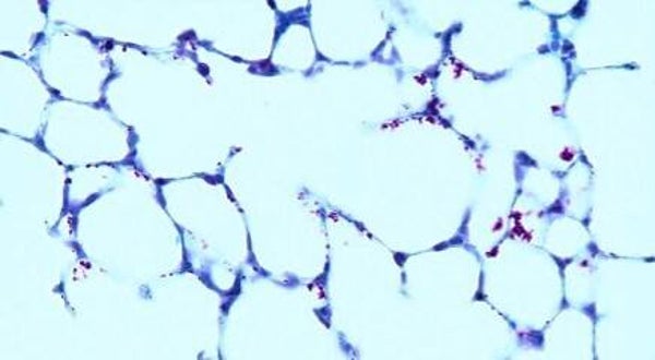 Acid Fast Bacteria Control Slides