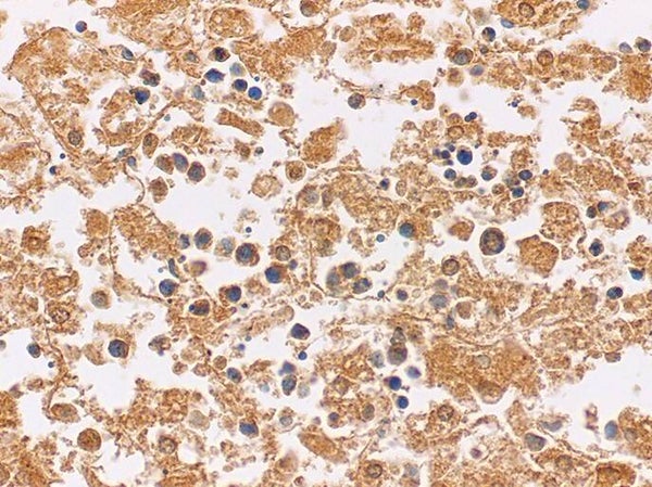 Alpha-1-Fetoprotein (AFP) Control Slides