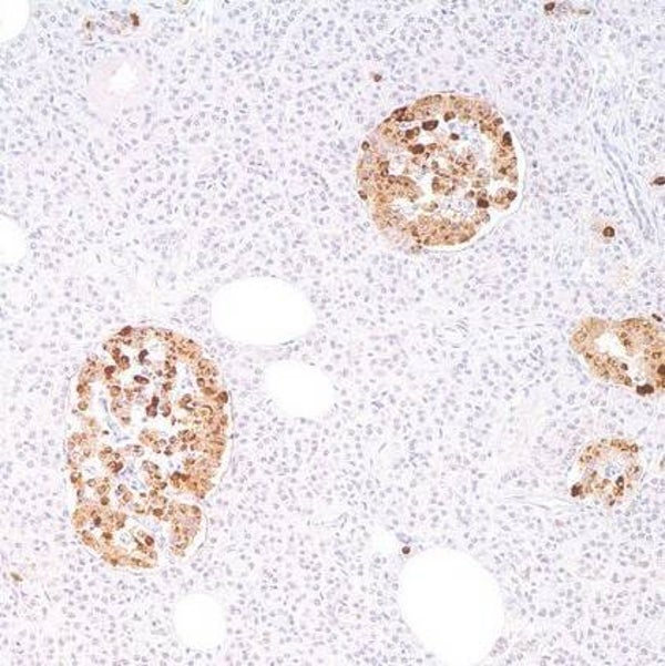 Chromogranin Control Slides