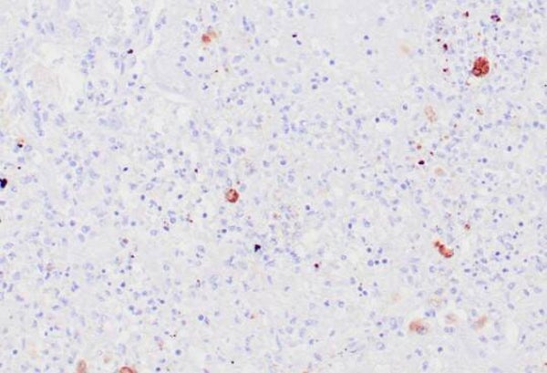 Herpes Simplex Virus, Type 2 (HSV-2) Control Slides