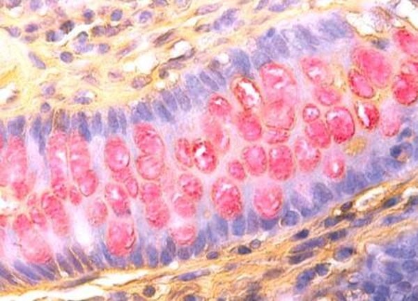 Mucin Control Slides