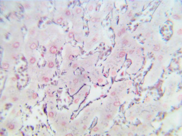 Reticulum Control Slides