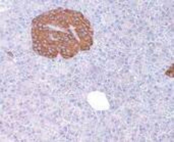 Synaptophysin Control Slides