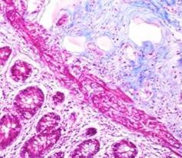 Trichrome - Colon - Control Slides