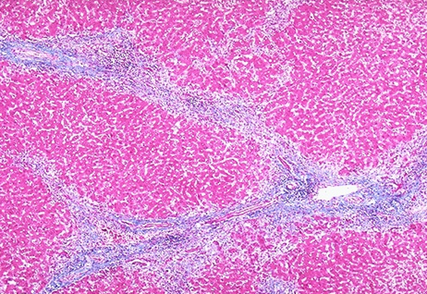 Trichrome - Liver - Control Slides