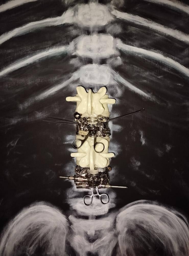 Spine Surgery RX (80cm X 60cm)