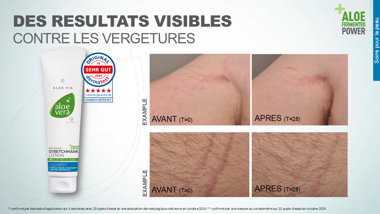 crème anti-vergetures Aloe Vera LR