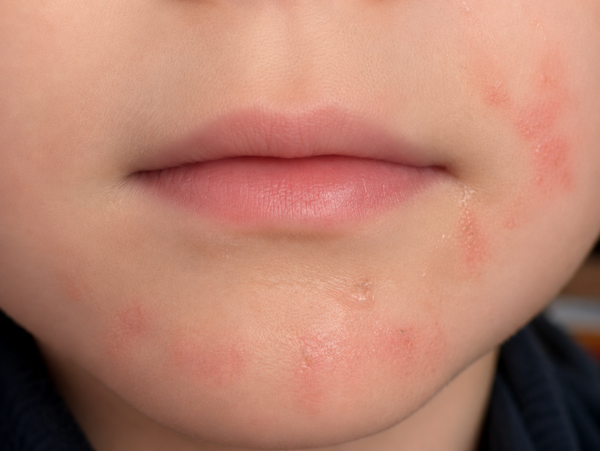 Delicate Mouth & Cheeks Cream / Crème douce pour la bouche et les joues