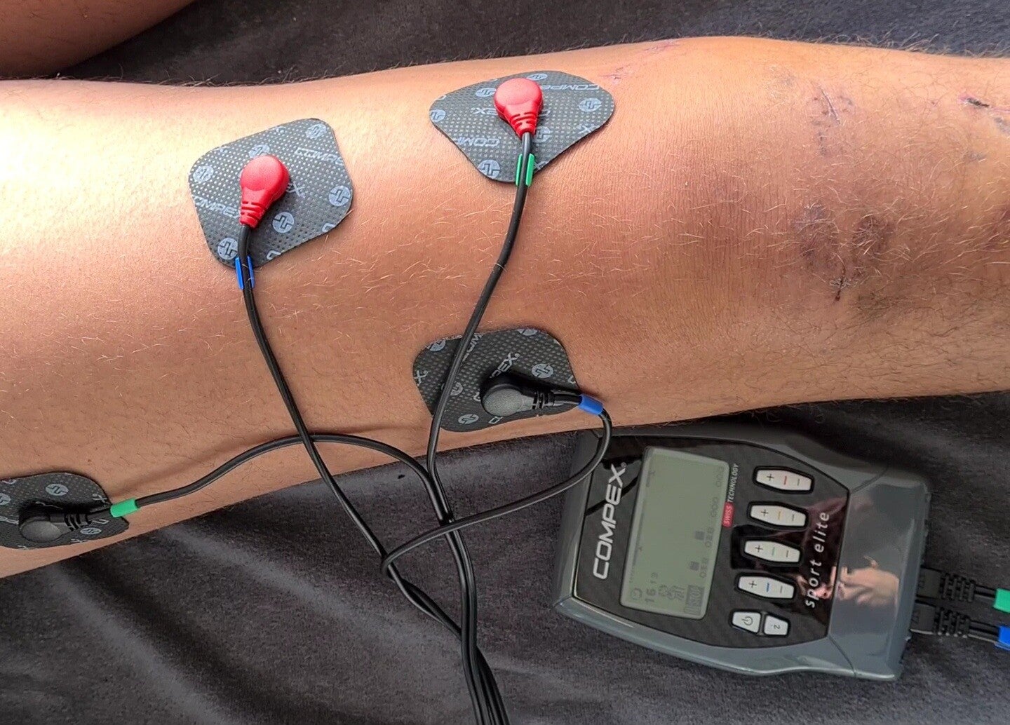 Revalidatie na een operatie