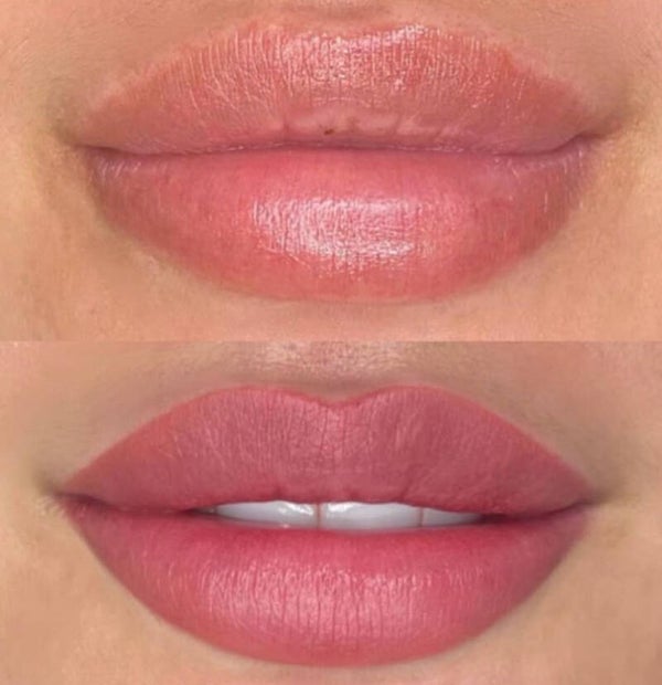 Formation Blushlips