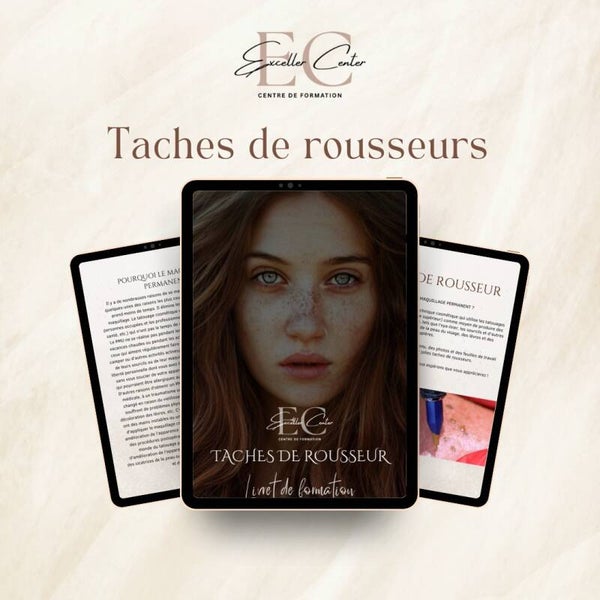 Formation Tâches de rousseur
