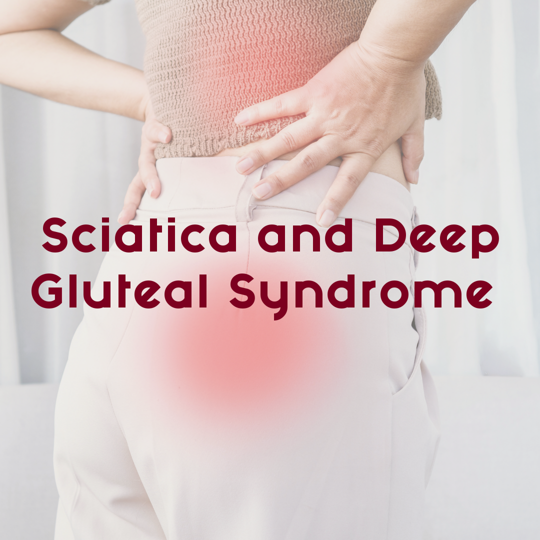 Sciatica and Deep Gluteal Syndrome