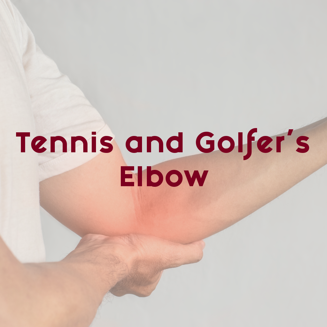 Tennis and Golfer's Elbow