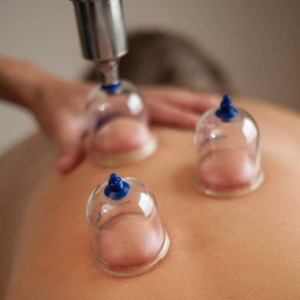 Cupping 1 dag