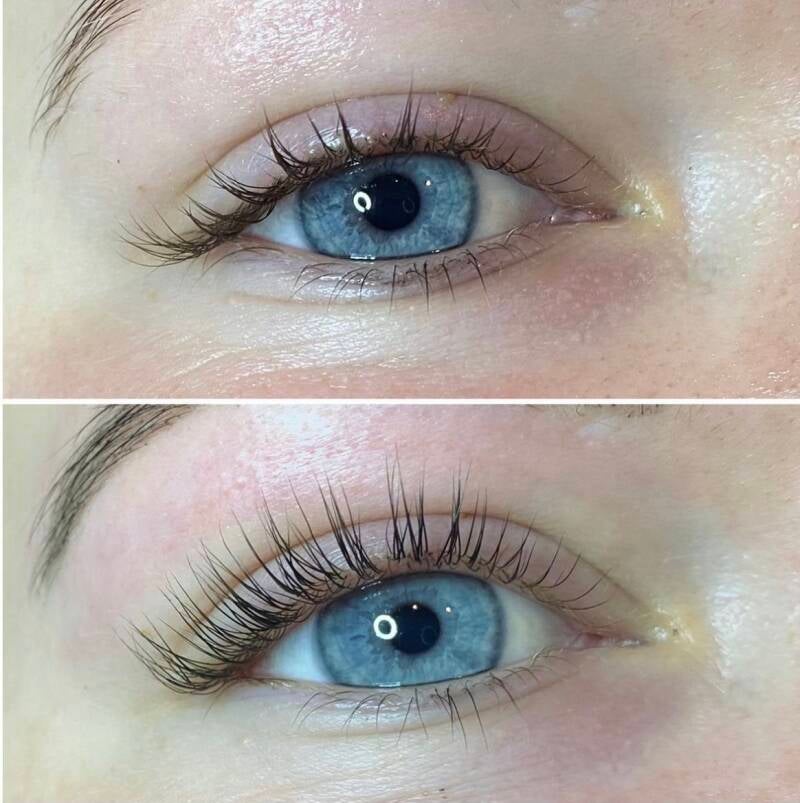 Lashlift