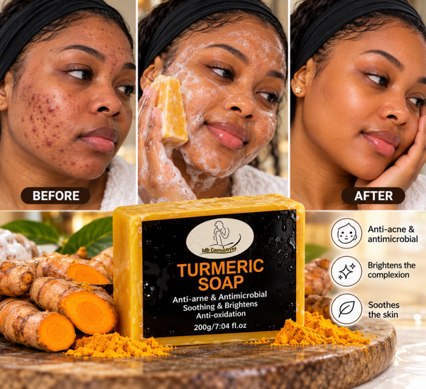 🌼 Turmeric Soap – Face & Body ✨ Anti-Acne | Brightening | Healing | Anti-Oxidant ✨