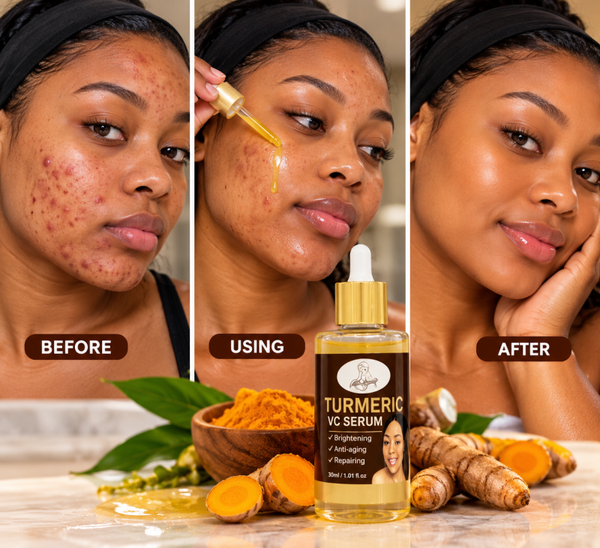 🌿 LDP Turmeric VC Serum