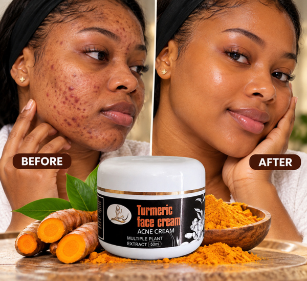Turmeric  Face Cream Blemish / hyperpigmentation