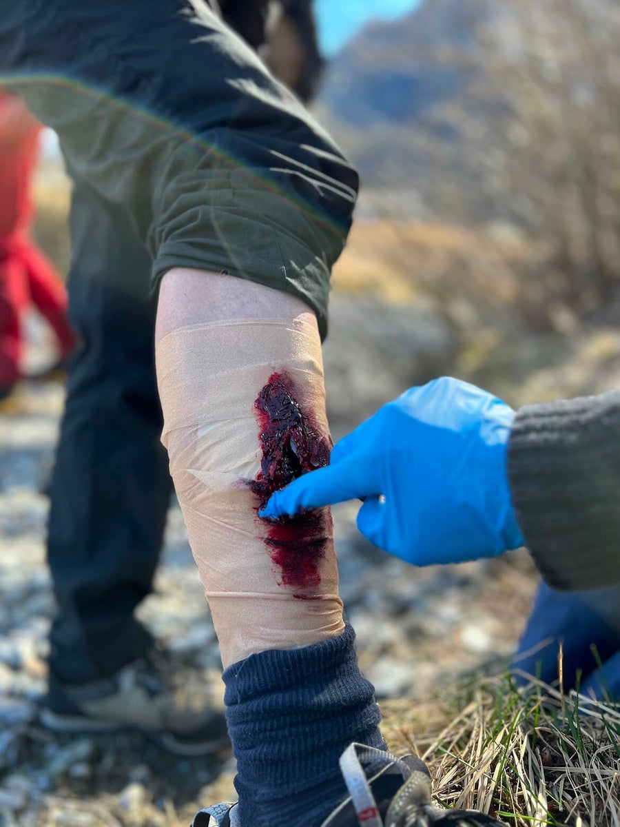 Close-up van het verzorgen van een wond met handschoenen tijdens de Wilderness First Aid cursus