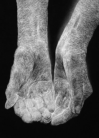 Zeichnung zu "Senile Körper, verkalkte Demenz" ca. B.70 cm x H.50 cm