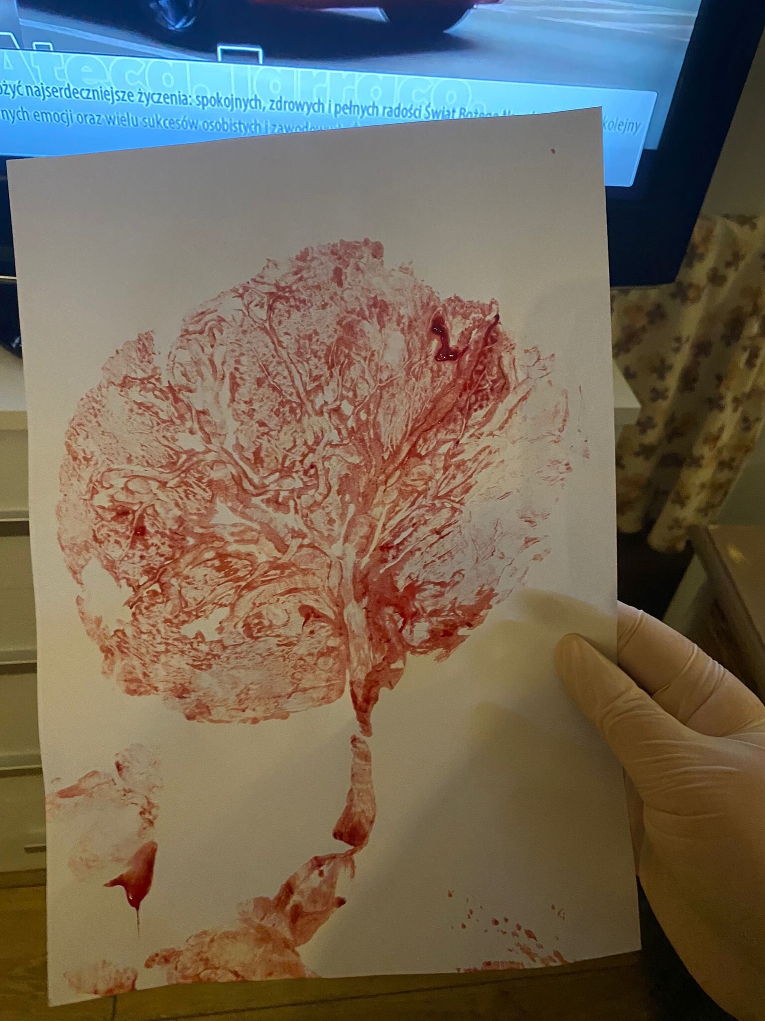 De placenta-afdruk op deze foto is van mijn kleinzoon
