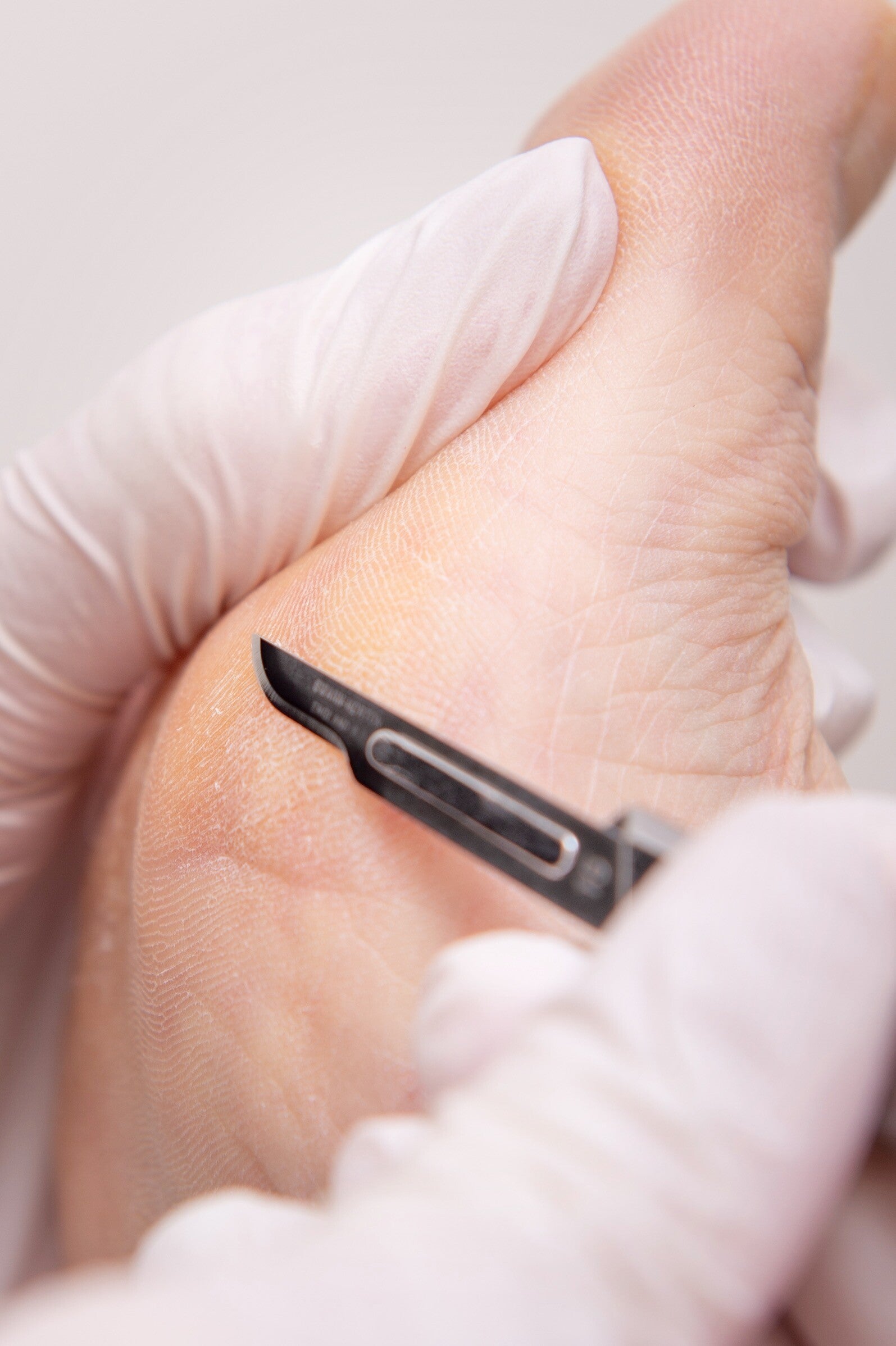 Pedicure Cosmononique Epe Pour Vous. Likdoorns verwijderen, eelt verwijderen