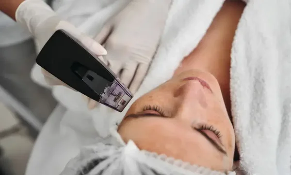 Level 5 RF MICRO-Needling