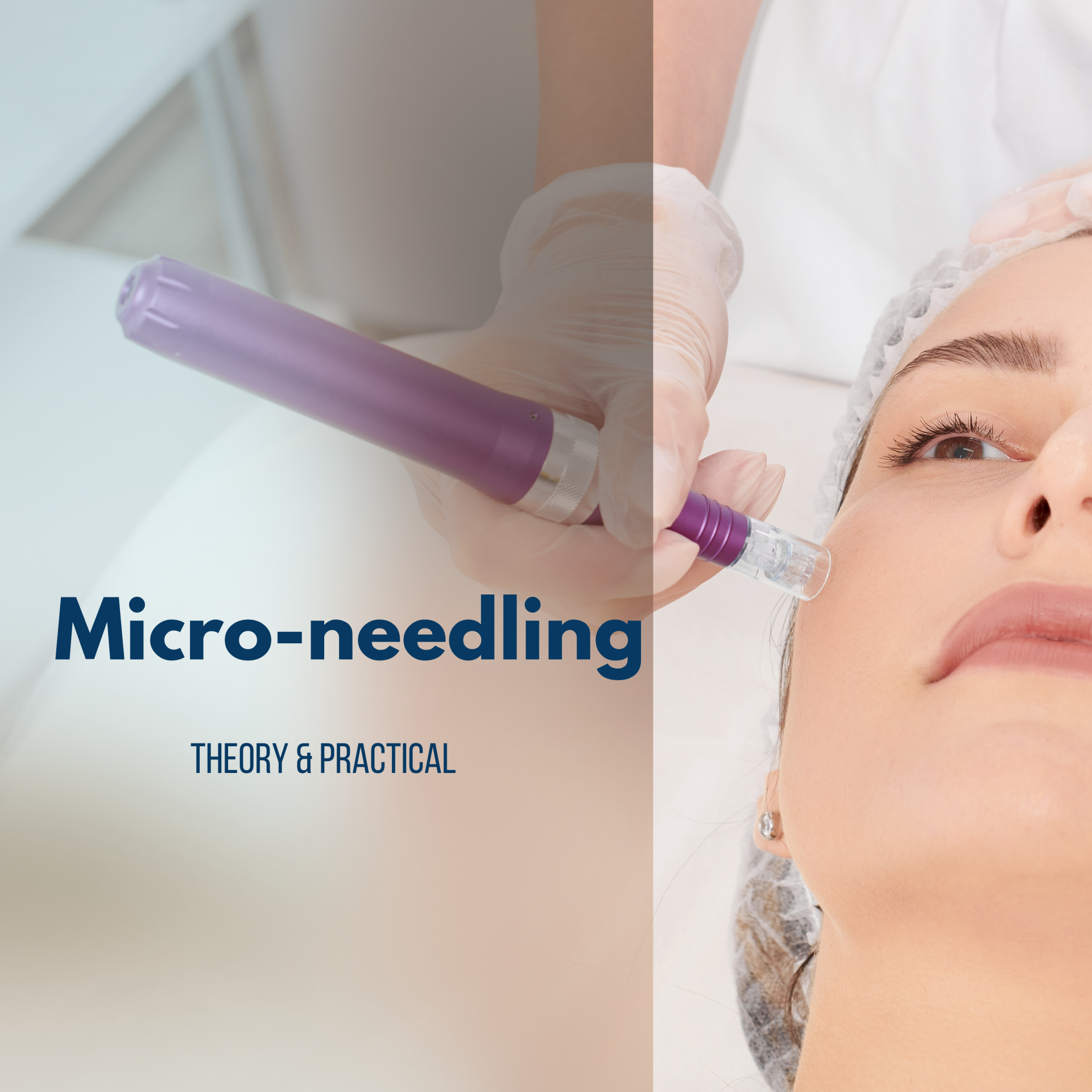 Microneedling