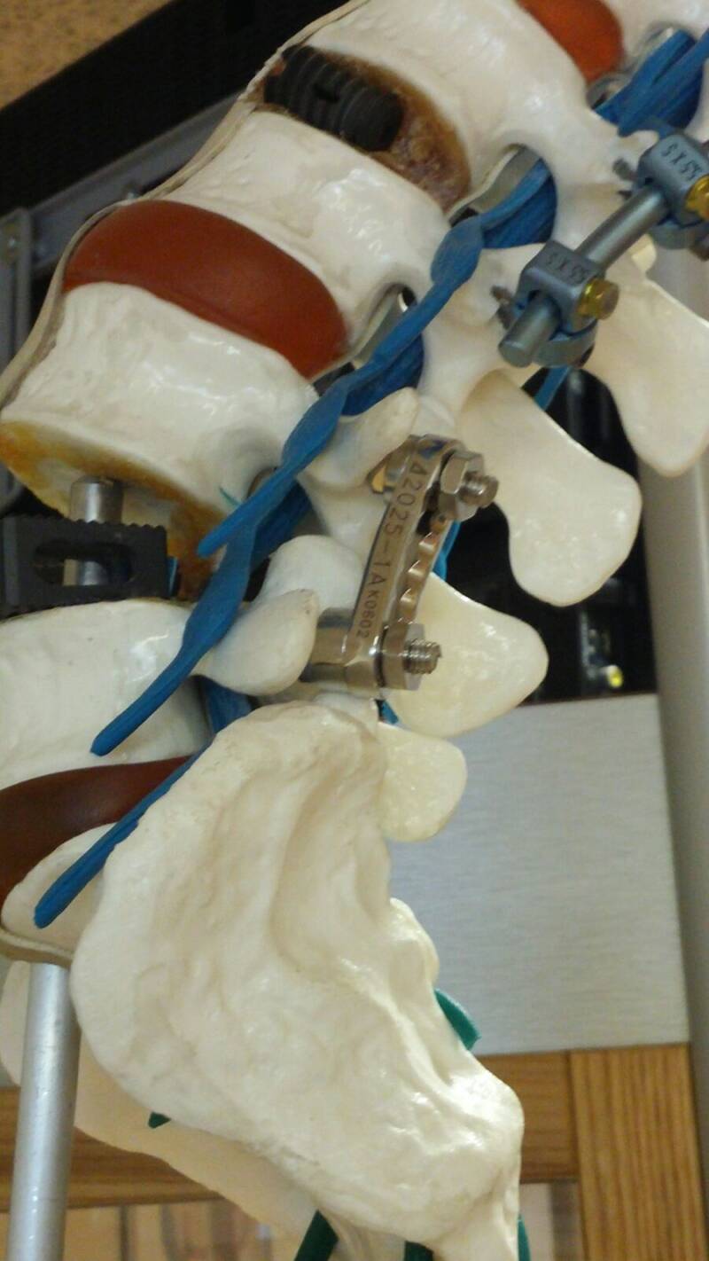 anatomiespondylodeseetzzijaanzicht.jpg