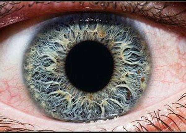 Basic Verbal Iris Analysis