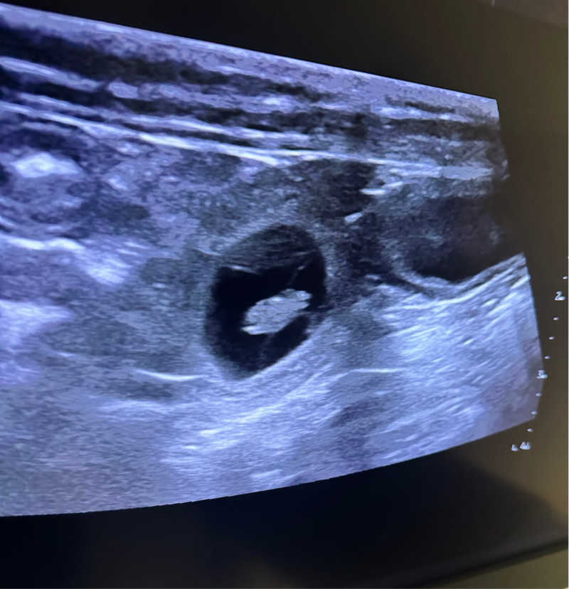 Trächtigkeitsultraschall