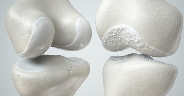 Collagène cartilage et os structure articulaire résistance des os et des articulations