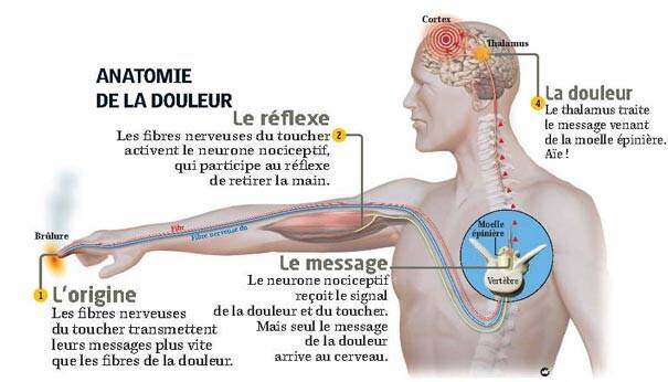 anatomie-de-la-douleur-standard-mioh8f.jpg