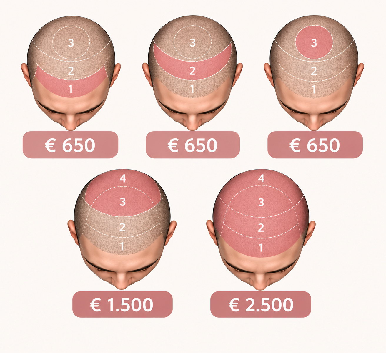 Prijzen scalppigmentatie bij Skintastic Brugge