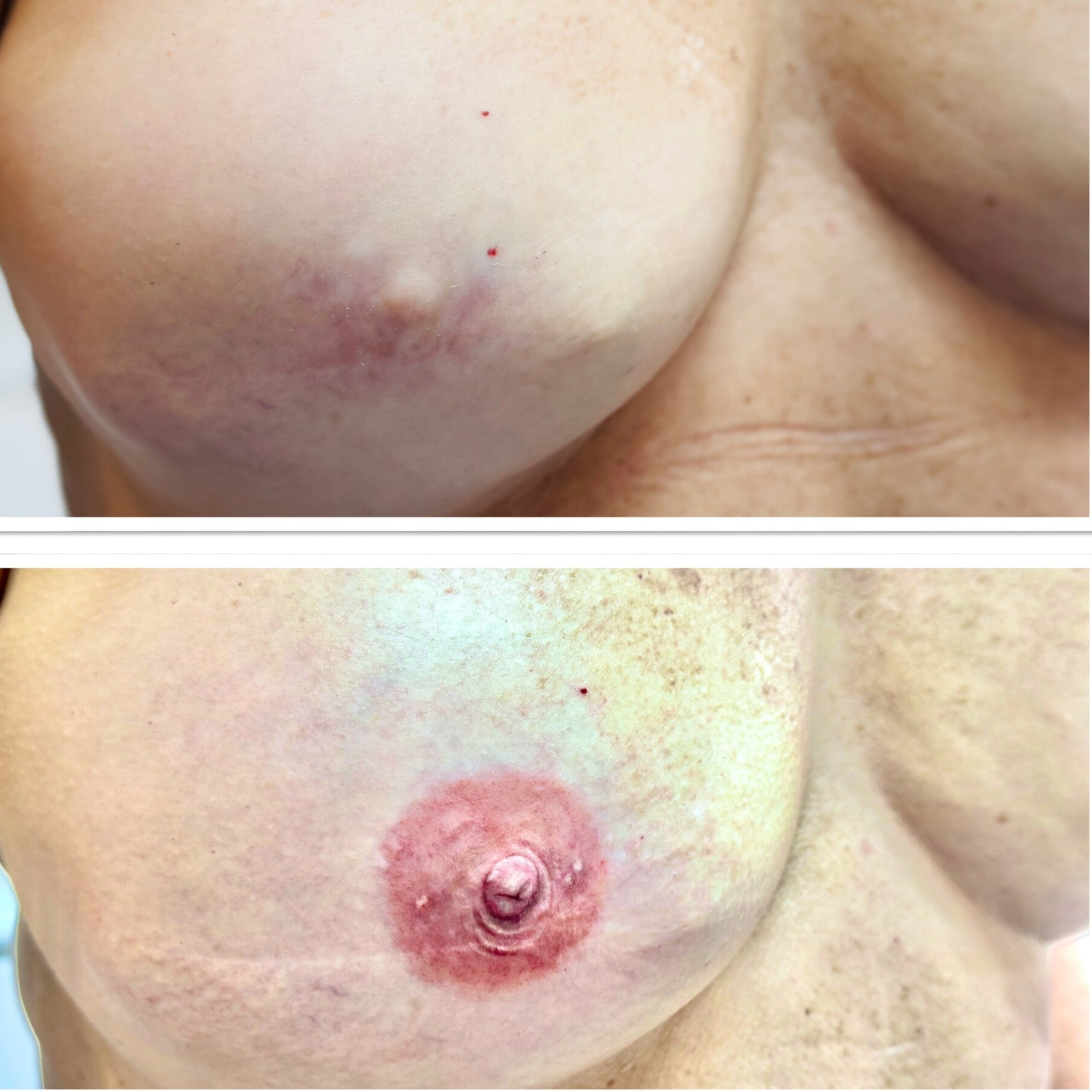 Waar kan ik een tepeltatoeage laten zetten in Brugge? War kan een tepeltatoeage laten doen in west-Vlaanderen? Areola tatoeage Brugge Beste tepelhoftatoeage Brugge Tattoo tepel Brugge Tatoeage tepels Brugge Sint-Kruis , 3D TEPELTATOEAGE AREOLA TATOEAGE 