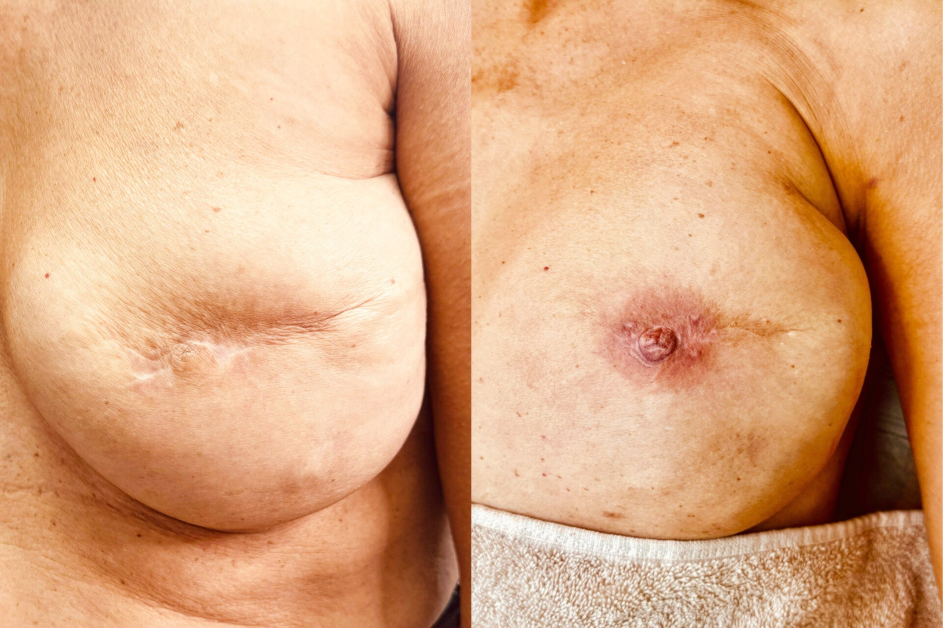 Waar kan ik een tepeltatoeage laten zetten in Brugge? War kan een tepeltatoeage laten doen in west-Vlaanderen? Areola tatoeage Brugge Beste tepelhoftatoeage Brugge Tattoo tepel Brugge Tatoeage tepels Brugge Sint-Kruis , 3D TEPELTATOEAGE AREOLA TATOEAGE 