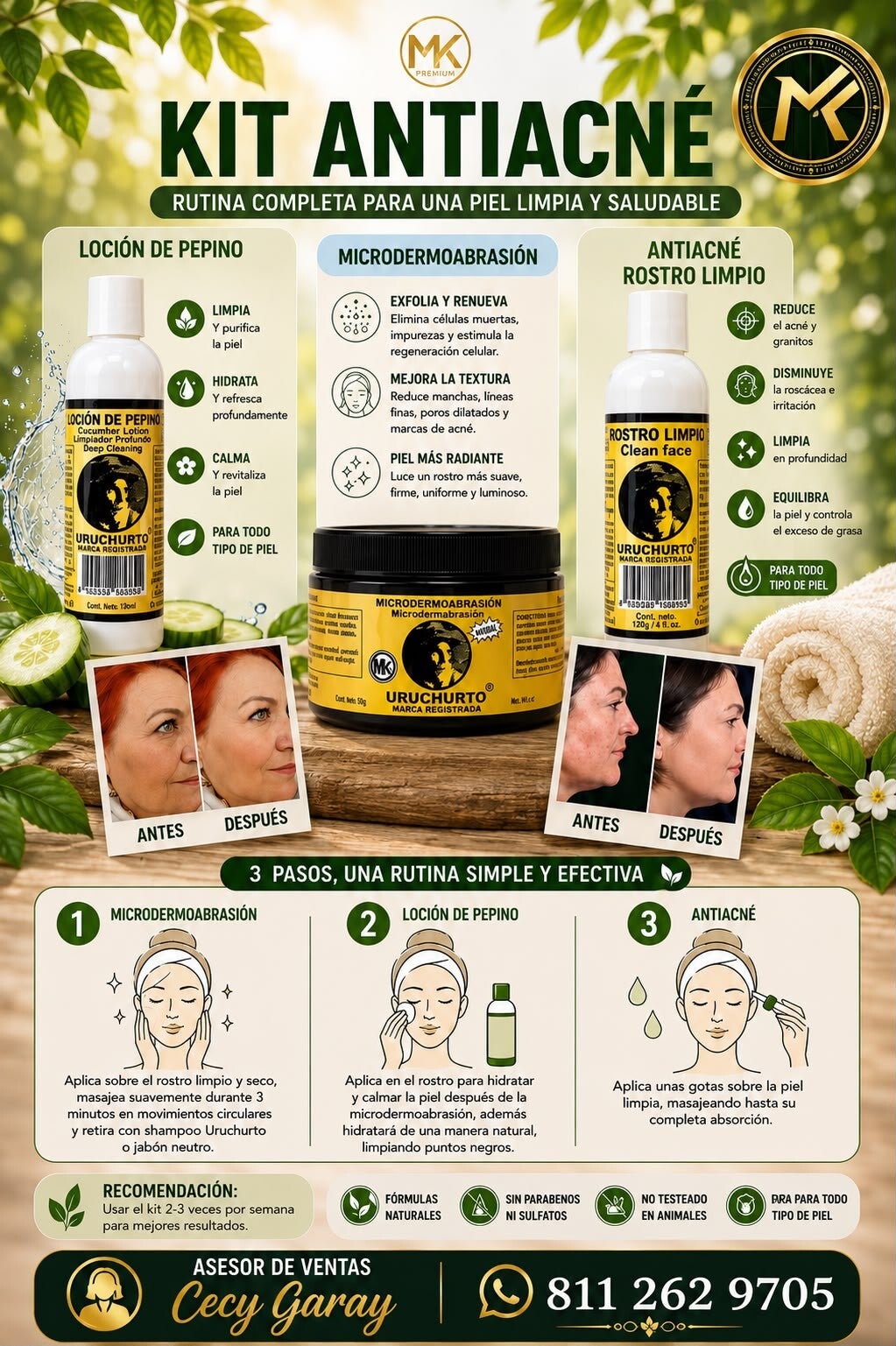 Kit Antiacne
