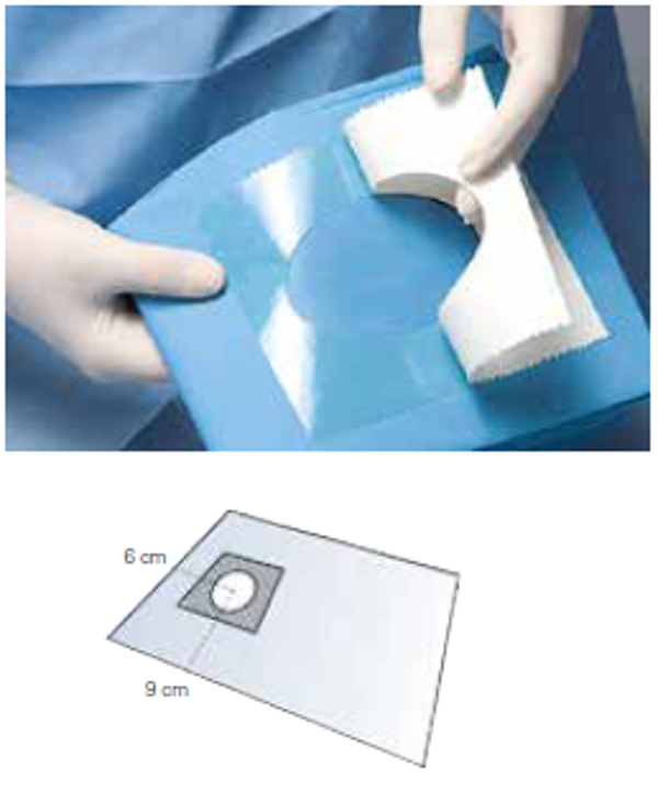12.T5332 PATIENT AFDEKDOEK STERIEL 100X150 CM, VENSTER 6X9 CM, MET PLAKSTRIP ( 25 st.)