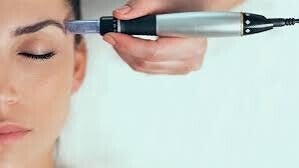 Microneedleing