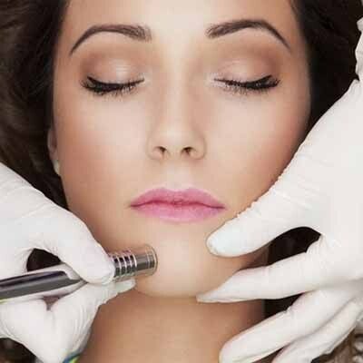 Microdermabrasion