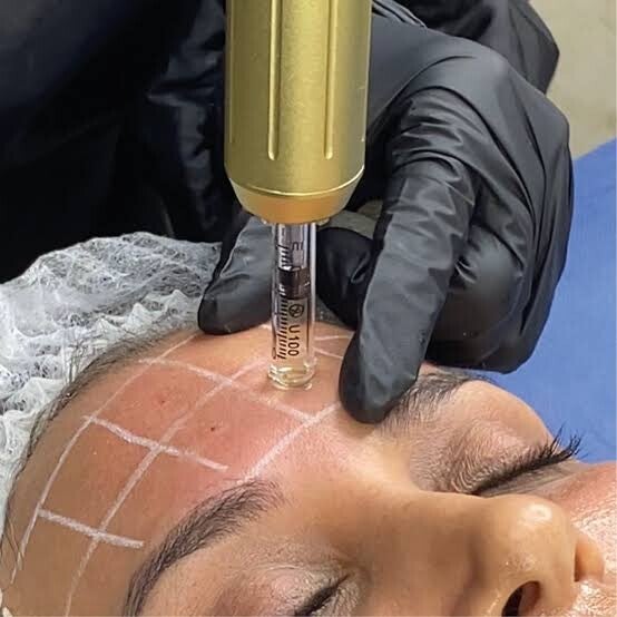 Mesotherapy
