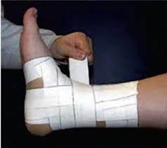 medical taping