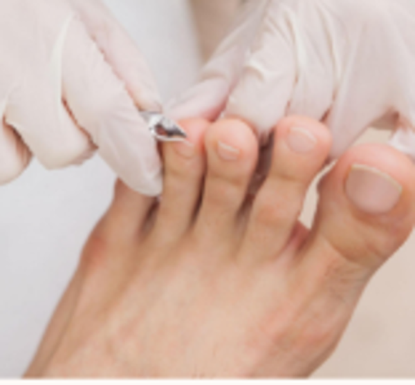 Pedicurebehandeling