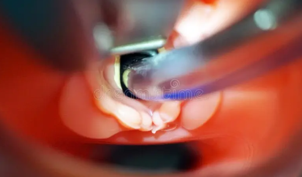 Advanced Airway Practices