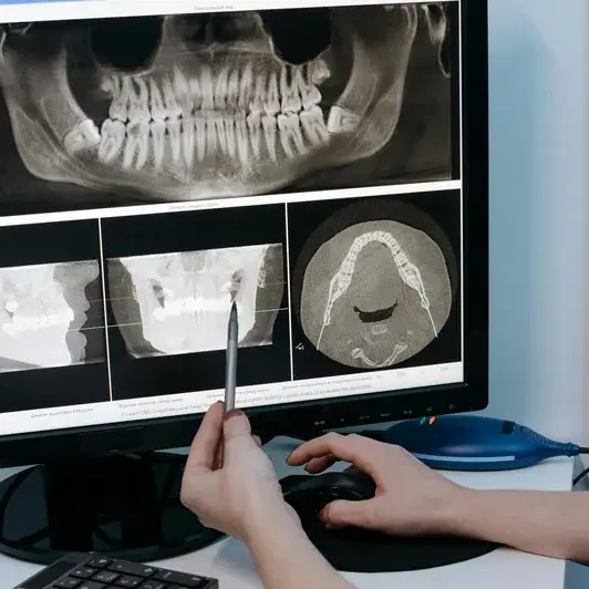 Circular photo of hands pointing to CBCT dental scan on screen showing full jaw X-rays