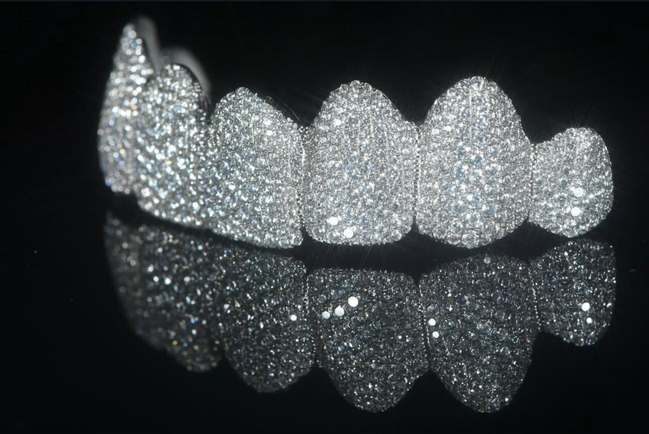 sparkling silver diamond grillz dental appliance, 3D CAD design examples for cosmetic dentistry