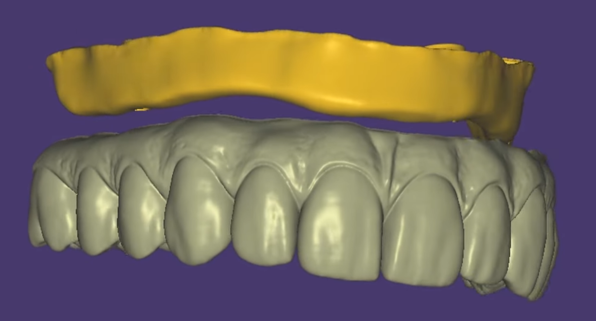 3D visual full arch cad cam design