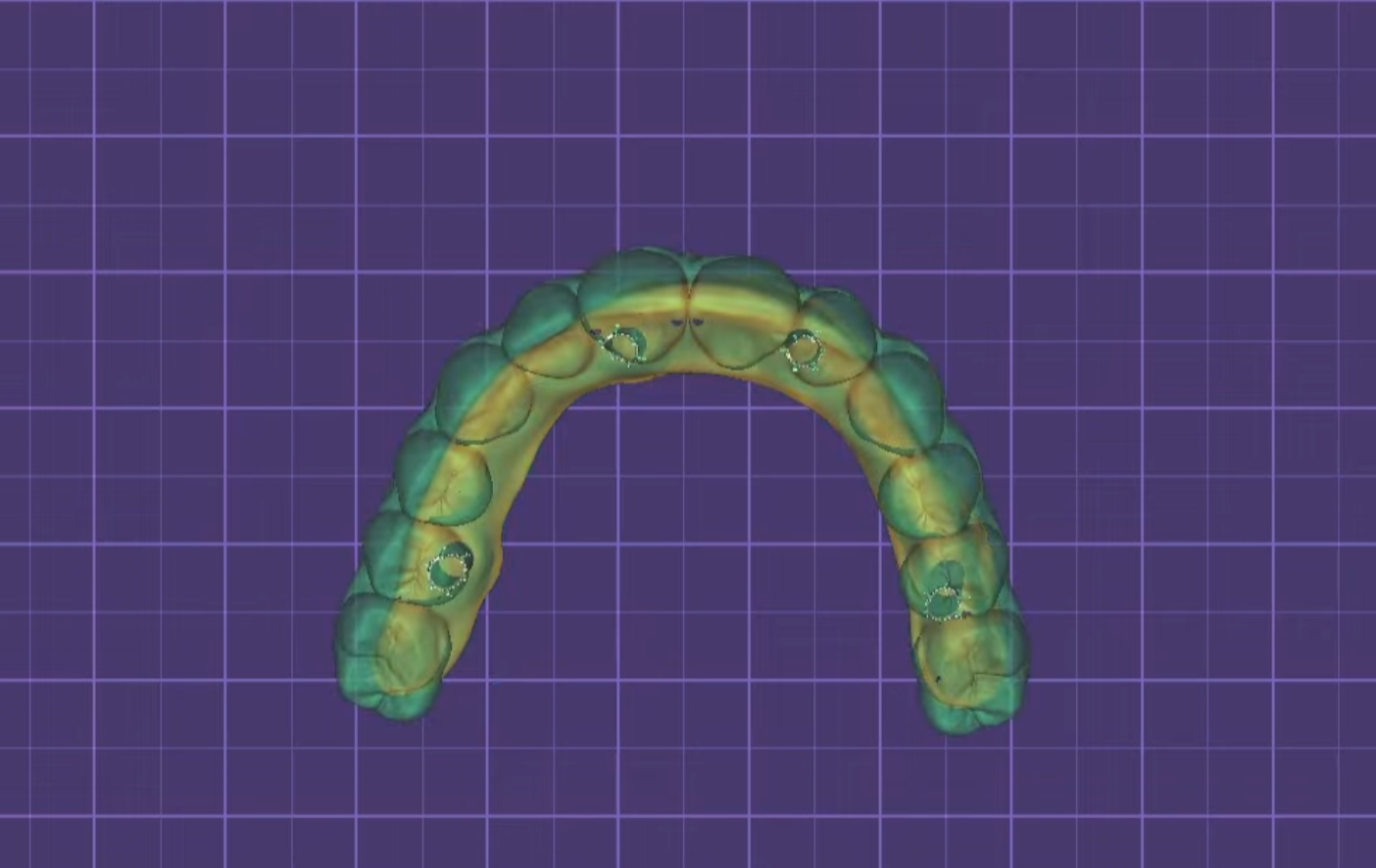 3D visual full arch cad cam design