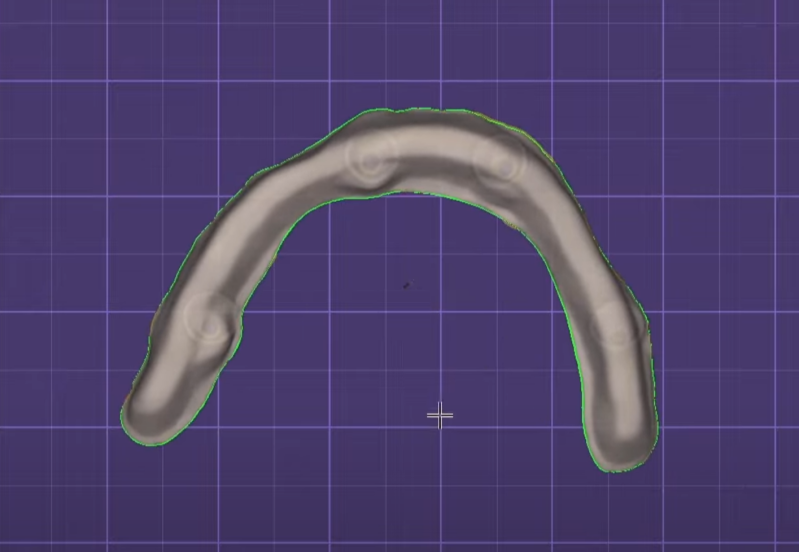 3D visual full arch cad cam design