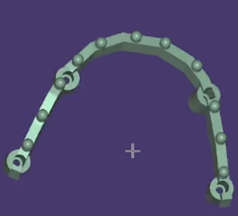 3d dental bar cad cam design